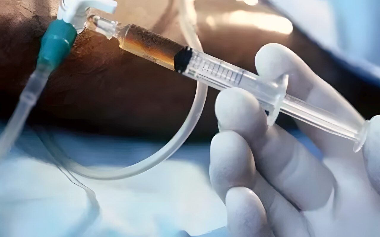 الإفتاء توضح حكم الشرع في القتل الرحيم