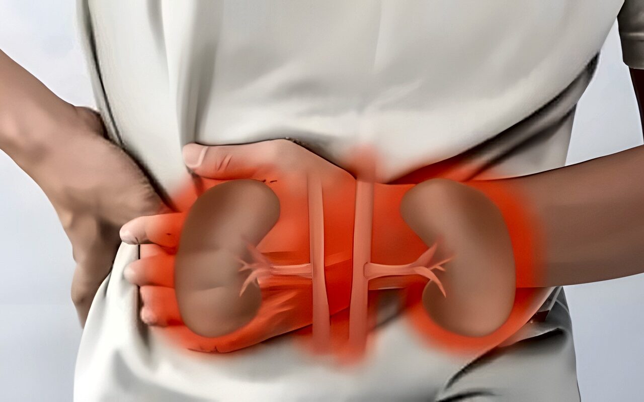 أعراض مبكرة تؤكد تلف الكلي.. تعرف عليها