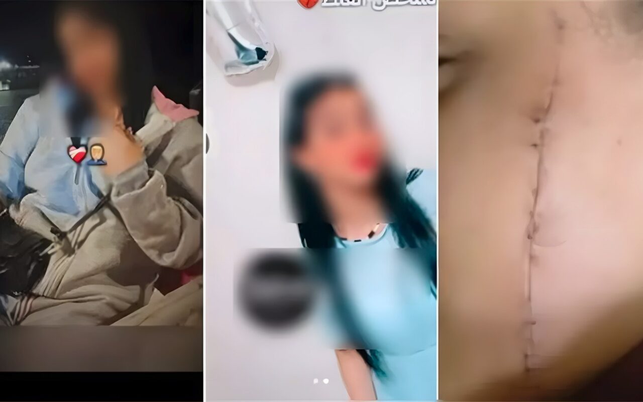 خلاف بين طالبتين ينتهي بإصابة إحداهما بجرح قطعي في الوجه أمام مدرسة بالإسكندرية