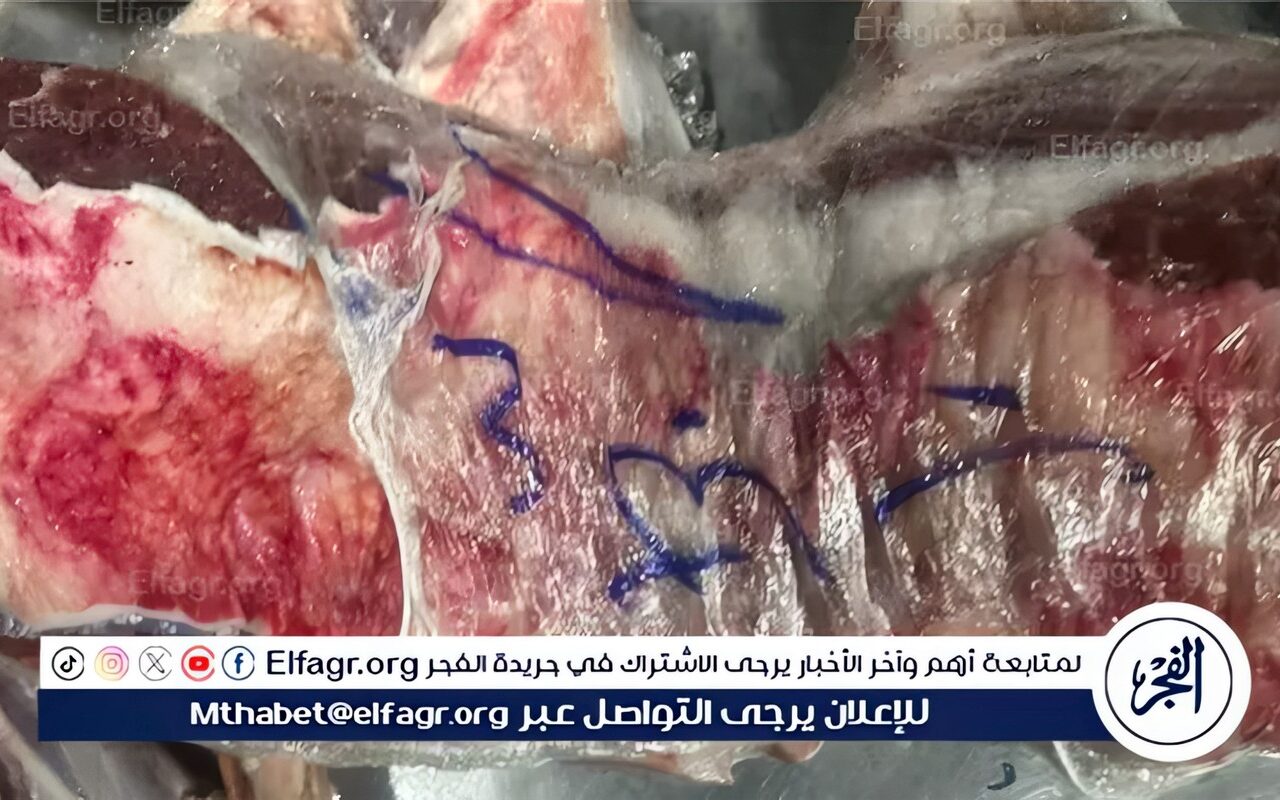الطب البيطري: ضبط 241 كجم من اللحوم والدواجن غير الصالحة للاستهلاك الآدمي بالمحافظة