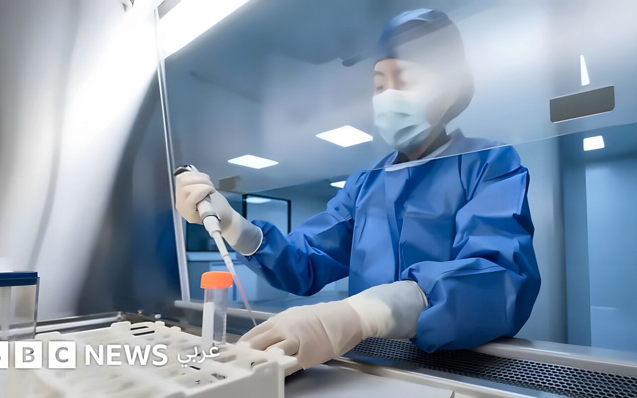 وفاة فنية مختبر في روسيا تثير مخاوف من الطاعون، ما حقيقة ما حدث وماذا نعرف عن المرض؟