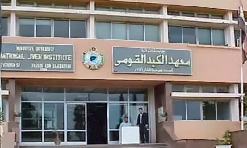 فريق معهد الكبد القومي بالمنوفية ينجح في استخراج تكوين جنيني من معدة طفلة