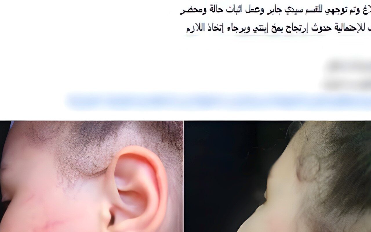 تعاني من فرط الحركة.. كشف ملابسات تعدي معلمة على تلميذة داخل مدرسة بالإسكندرية