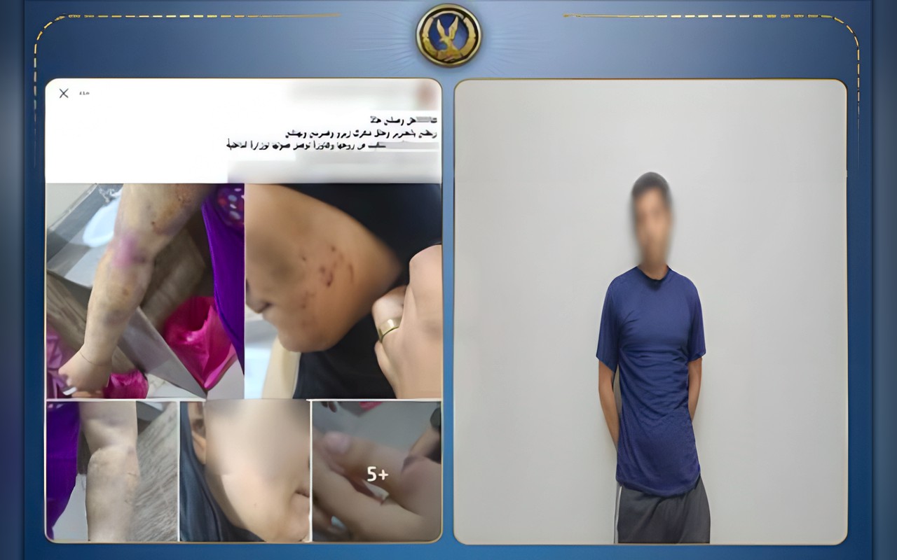 الداخلية تكشف ملابسات تعذيب سيدة على يد زوجها باستخدام «جنزير وعصا»