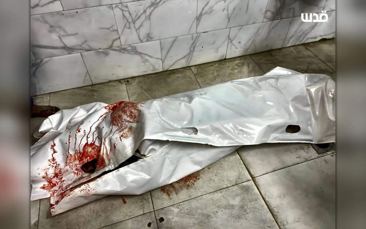 مجزرة بحق الموظفين المدنيين.. 4 شهداء وأكثر من 30 مصابا في غزة