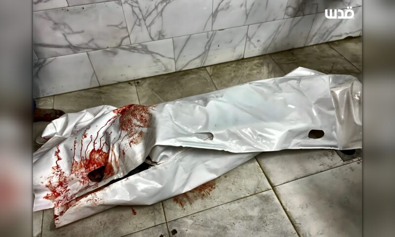 مجزرة بحق الموظفين المدنيين.. 4 شهداء وأكثر من 30 مصابا في غزة